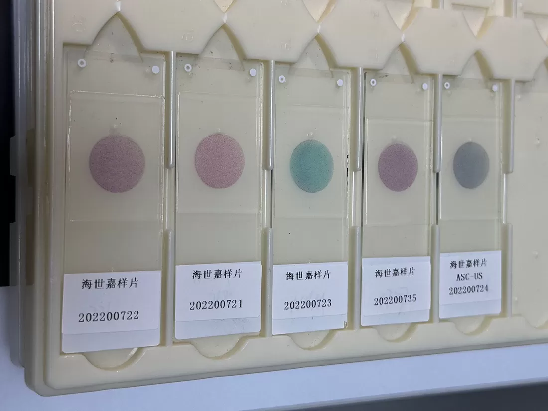 Как правильно интерпретировать результаты Pap Stain